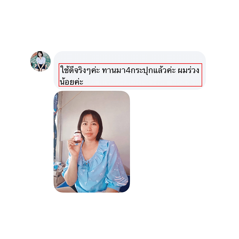 รีวิว HORSY ผมร่วง ผมบาง รอยแสกกว้าง - 16