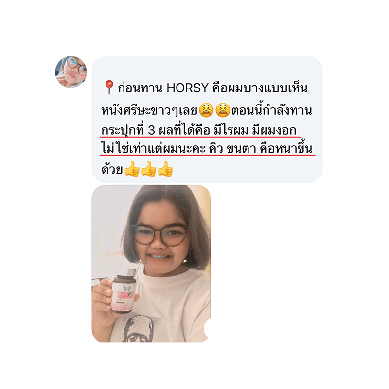 รีวิว HORSY ผมร่วง ผมบาง รอยแสกกว้าง - 9