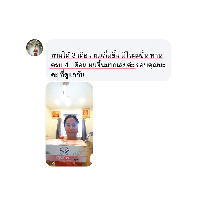 รีวิว HORSY ผมร่วง ผมบาง รอยแสกกว้าง - 4