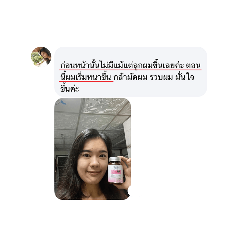 รีวิว HORSY ผมร่วง ผมบาง รอยแสกกว้าง - 2