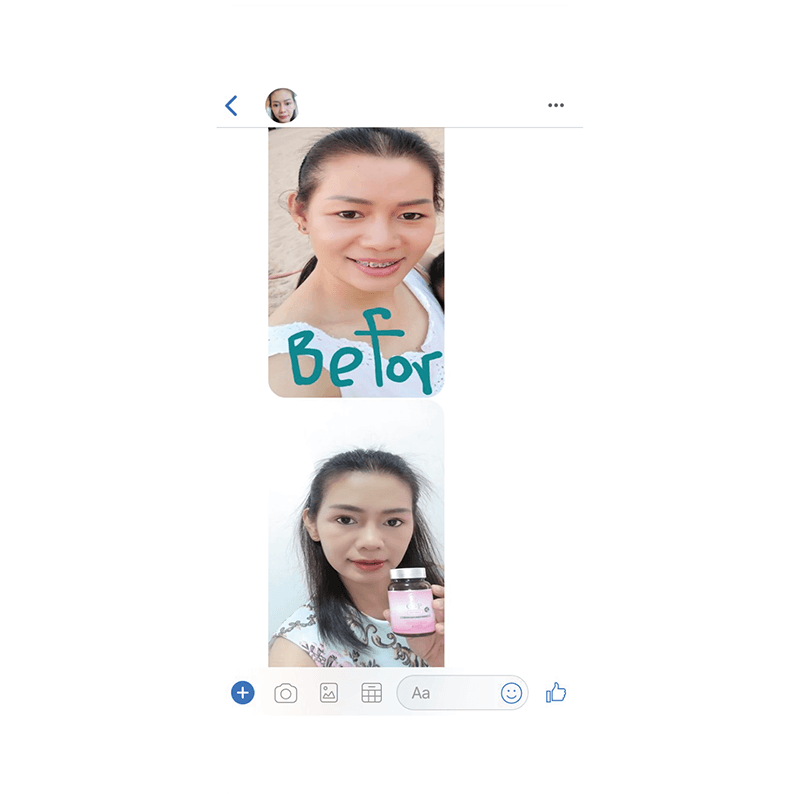 รีวิว HORSY ผมร่วง ผมบาง รอยแสกกว้าง - 30