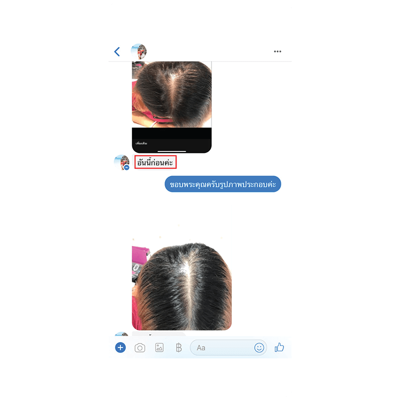 รีวิว HORSY ผมร่วง ผมบาง รอยแสกกว้าง - 28