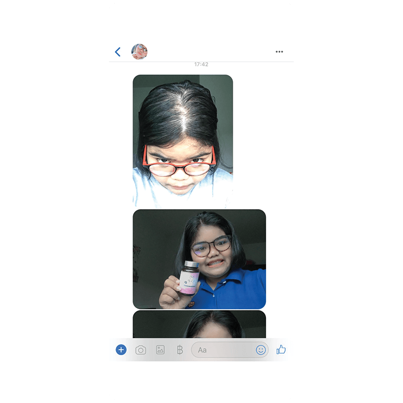 รีวิว HORSY ผมร่วง ผมบาง รอยแสกกว้าง - 25