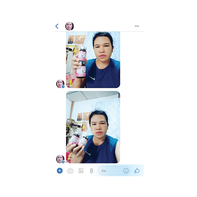 รีวิว HORSY ผมร่วง ผมบาง รอยแสกกว้าง - 14