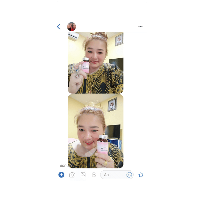 รีวิว HORSY ผมร่วง ผมบาง รอยแสกกว้าง - 13