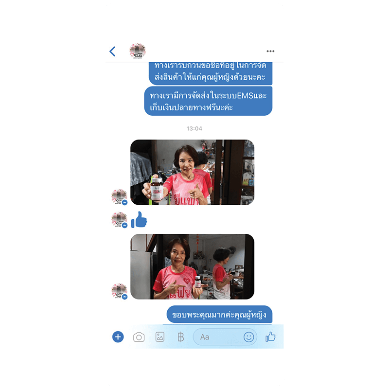 รีวิว HORSY ผมร่วง ผมบาง รอยแสกกว้าง - 12