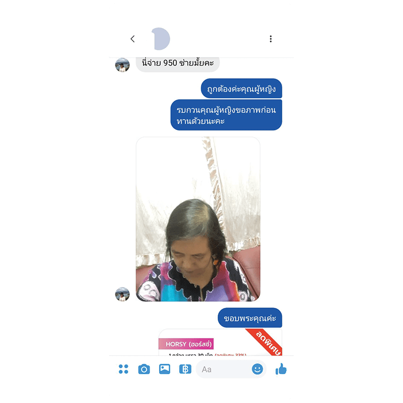 รีวิว HORSY ผมร่วง ผมบาง รอยแสกกว้าง - 5